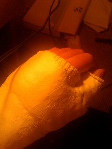 My hand - when it broke two years ago and osteoporosis was discovered